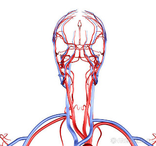 ateroslkeroz brahiocefalnyh arterij