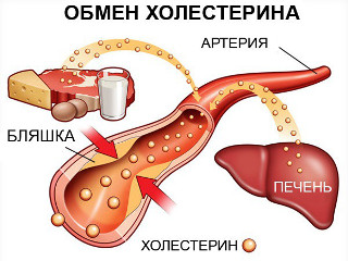 prichiny stenocardii1