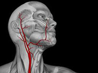 stenoz sonnoj arterii