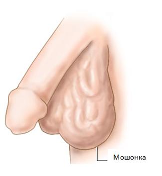 diagnostika varikocelle